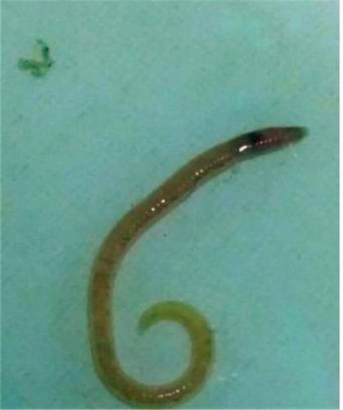 水线虫能活多久