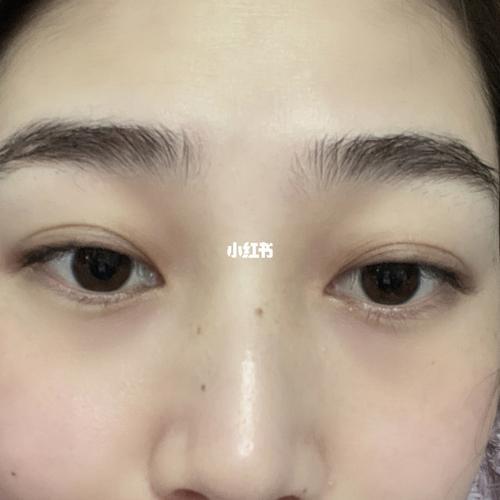 夫妻都是内双小孩会外双吗