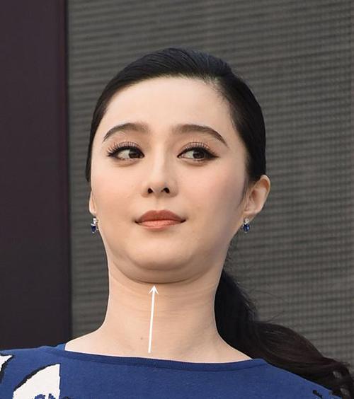 男朋友说你有双下巴该怎么回