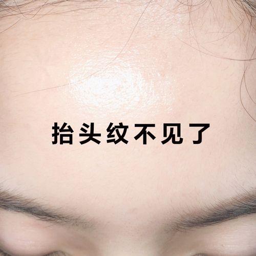 抬头纹淡化神器