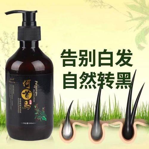 治白发最好的洗发水