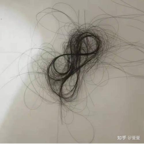 柔顺后掉头发严重怎么办