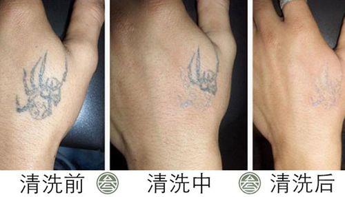 纹身如何洗掉