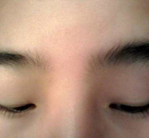 为什么我的眉毛像个倒八字