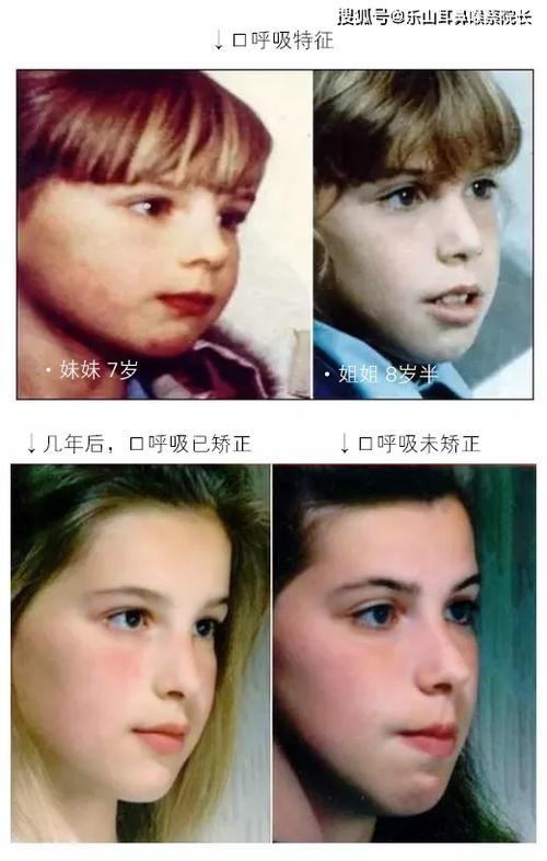 吃饭嘴巴应该张开还是闭着