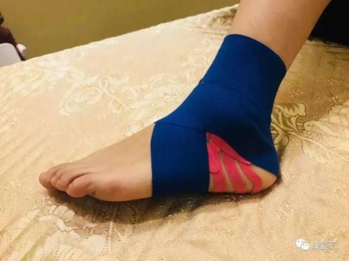 鞋子砍脚脖子怎么回事