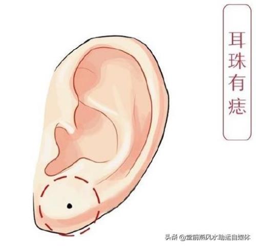 耳朵上哪个部位叫耳珠