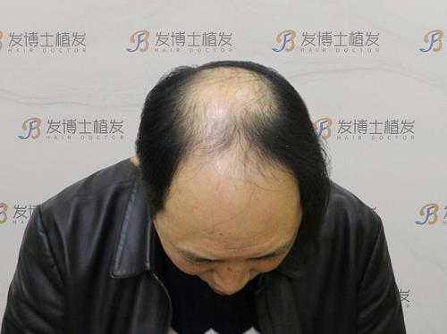 地中海头发怎么剪