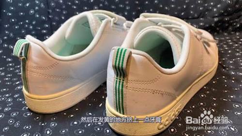 鞋边变黄了怎么变白最有效方法