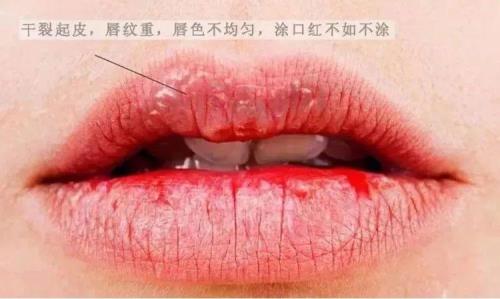 嘴唇干裂怎么涂口红