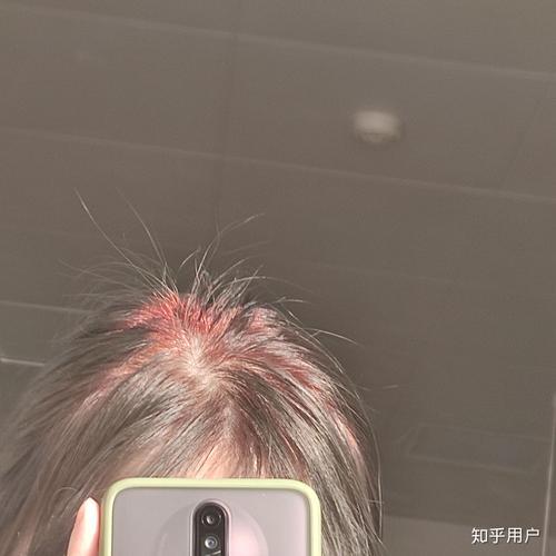 染发爆顶怎么补救
