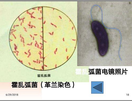 大肠杆菌纤毛和鞭毛的区别