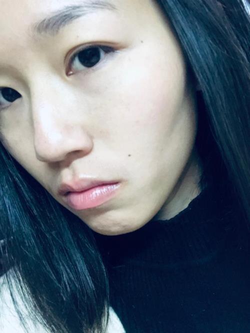 苹果前置摄像头雾蒙蒙怎么办