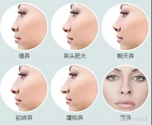 一什么鼻子
