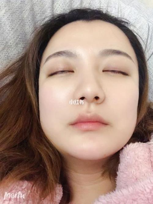 照片闭眼睛怎么p成睁眼睛