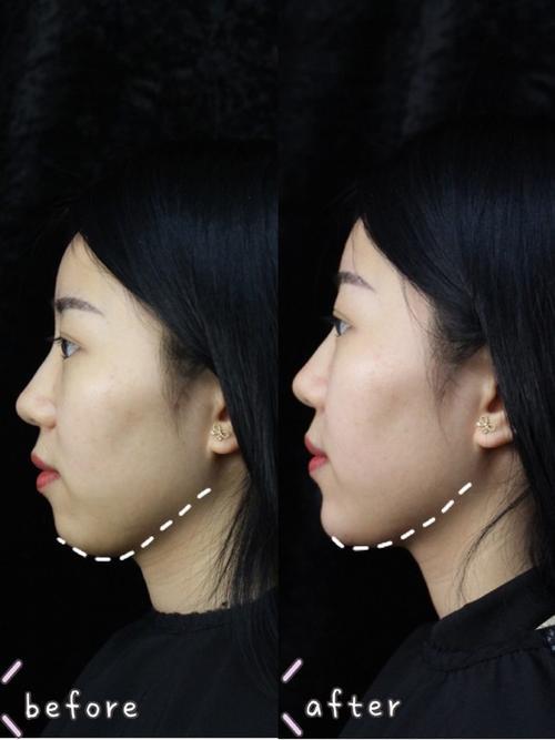 下巴翘得好看吗