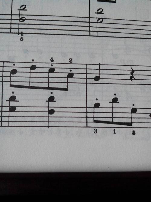 音线分为哪几类