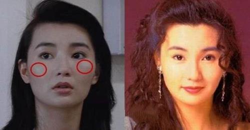 颧骨大瘦下来好看吗