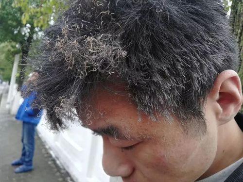 头发焦了是什么样子的