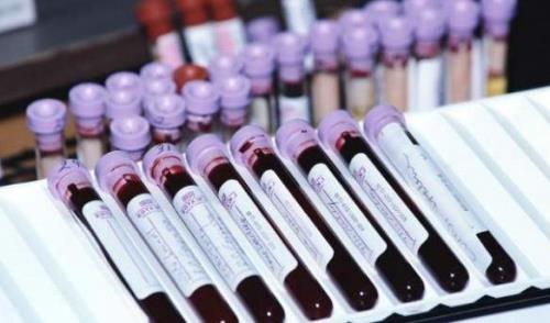 医院输一袋400升的血多少钱