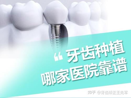 苏州哪里种植牙最便宜