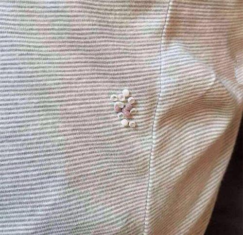 为什么白色衣服晒着好多虫