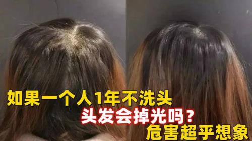 一个月不洗头会怎样
