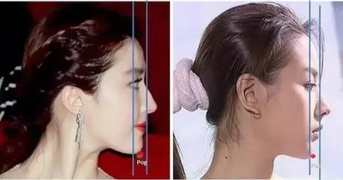 下巴是翘好看还是平