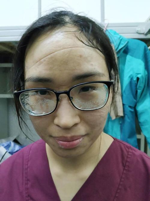 眼镜勒痕怎么处理方法