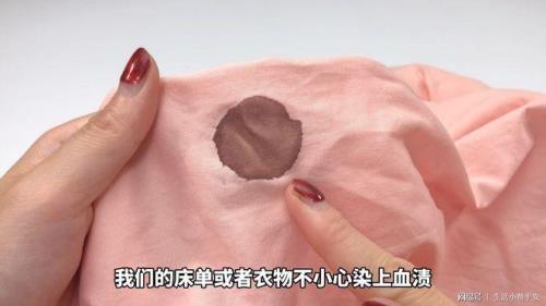干涸已久血渍清洗妙招