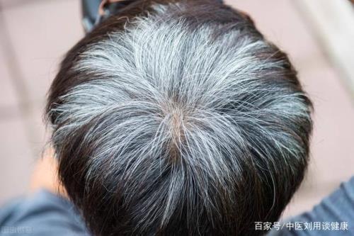白头发怎么改善