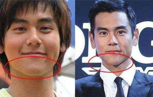 彭于晏的下巴为什么那么长